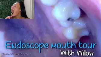 Endoscope Mouth Tour - Willow Lansky - HD 720 MP4