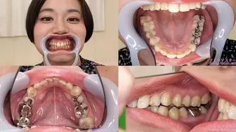 Kanna - Watching Inside mouth of Japanese cute girl bite-220-1