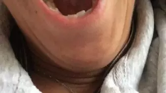 Check out my throat!