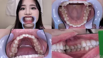 Rei - Watching Inside mouth of Japanese cute girl bite-221-1 - wmv 1080p