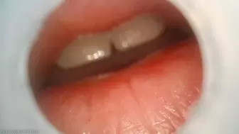 burping deep throat endoscopy (720 mp4)