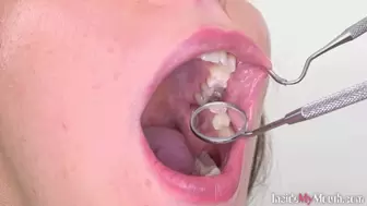 Inside My Mouth - Nikol got a mouth exam (4K)