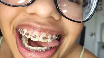 INSIDE My Mouth - SweetMari17 - Tongue, Teeth, Braces and Mouth Fetish