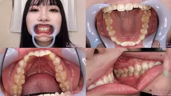 Kurumi - Watching Inside mouth of Japanese cute girl bite-212-1 - wmv