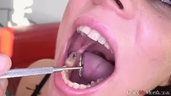 Inside My Mouth - Alena got mouth exam (HD)
