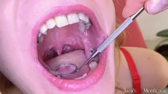 Inside My Mouth - Radka got mouth exam (4K)