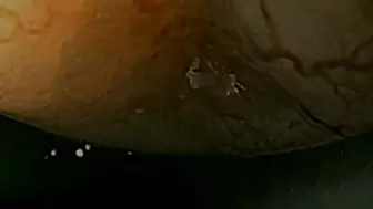 Looped anal trip in hemorrhoid filled asshole - Vore endoscopy video with heartbeat
