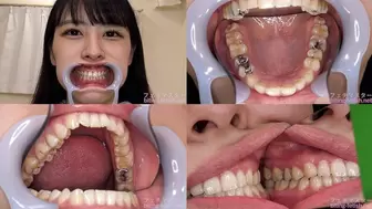 Akari - Watching Inside mouth of Japanese cute girl bite-219-1