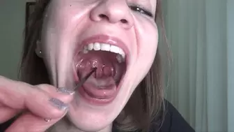 Show throat and touch the uvula (M)