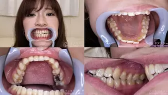 Sara - Watching Inside mouth of Japanese cute girl bite-222-1 - wmv 1080p