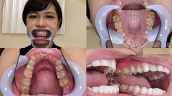 Fuuka - Watching Inside mouth of Japanese cute girl bite-224-1