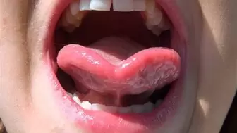 My Open Mouth HD-1080