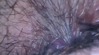 Hairy ass exploration with endoscope and farts 4K avi
