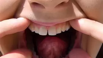 My Open Mouth HD-720