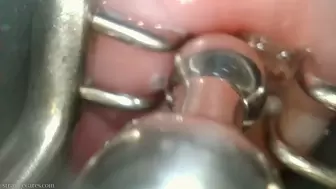 cervix pried open and penetrated (1080 wmv)